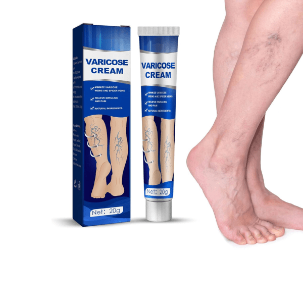 Pomada Varicose Cream – Para Varizes e Vasculite - Ortopebrasil